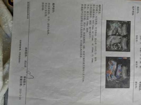 二十四周胎儿腿偏小两周正常吗,胎儿偏小二周有问题吗会胎停吗 第1张 二十四周胎儿腿偏小两周正常吗,胎儿偏小二周有问题吗会胎停吗 第1张