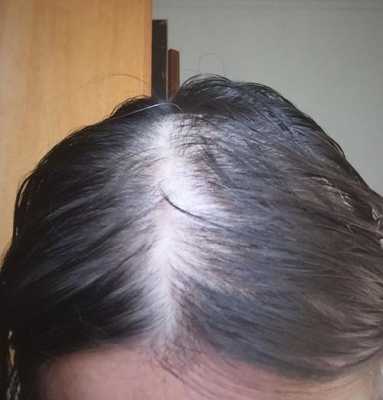 为什么怀孕后,身上毛发生长慢了,孕期头发不掉了怎么回事 第1张 为什么怀孕后,身上毛发生长慢了,孕期头发不掉了怎么回事 第1张