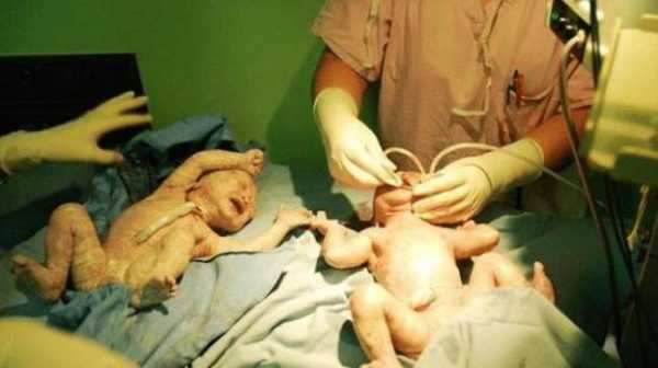 双胞胎孕期图片（38岁的媳妇怀了双胞胎压力大）  第2张