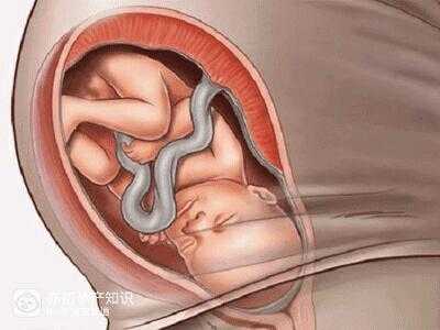 胎儿有时候踢很痛，是怎么回事,九个月胎儿踢得特别疼正常吗  第2张