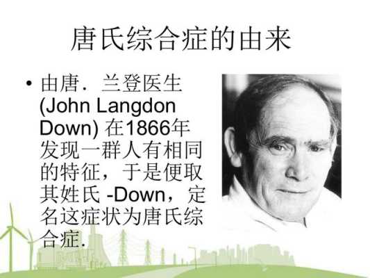 孕期伴随综合症(唐氏综合征介绍,唐氏综合征是什么病) 第1张 孕期伴随综合症(唐氏综合征介绍,唐氏综合征是什么病) 第1张