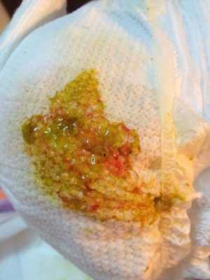 怀孕期间便血(怀孕期间便血怎么回事) 第2张 怀孕期间便血(怀孕期间便血怎么回事) 第2张